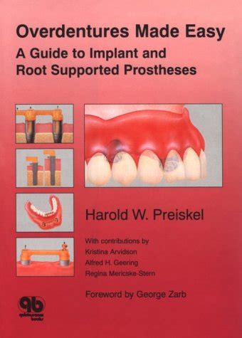 Overdentures made easy a guide to implant and root supported prostheses. - African american history teacher guide 2008.