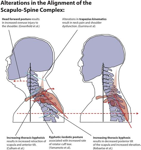 Overlapping, Masquerading, and Causative Cervical Spine and …