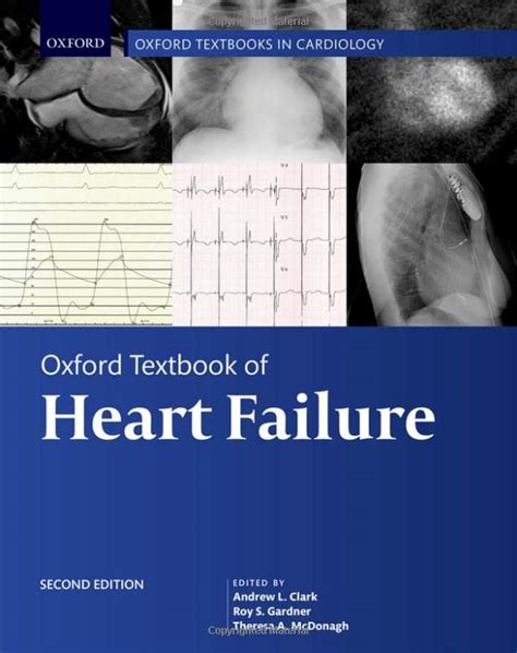 Oxford textbook of heart failure online oxford textbooks in cardiology. - Nissan navara stx 550 workshop manual.