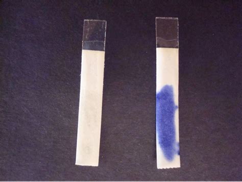 Oxidase Test