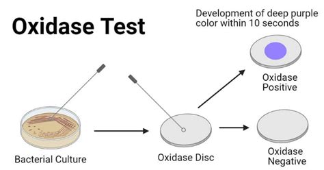 Oxidase test 원리