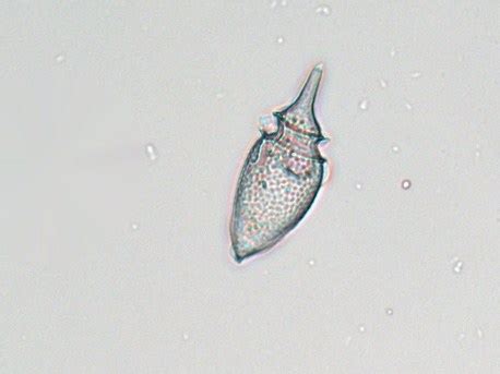 Oxyphysis IFCB