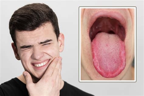 PAIN CONTROL: The Burning Mouth Syndrome - Oral Health …