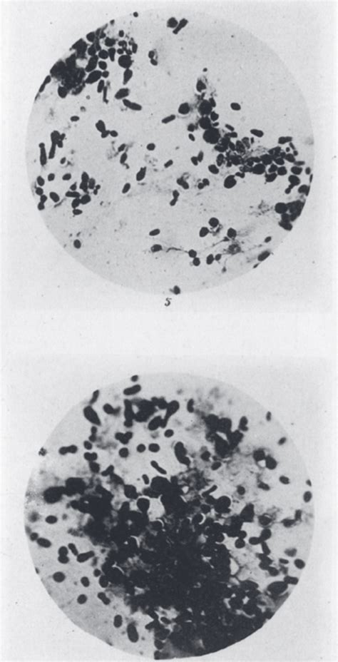 Pandemi pes ketiga - Wikipedia bahasa Indonesia, … - wintechmobiles.com