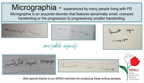 Parkinson and Micrographia: Exercises to Slow Down the Shrinking of ... - muktibox.com