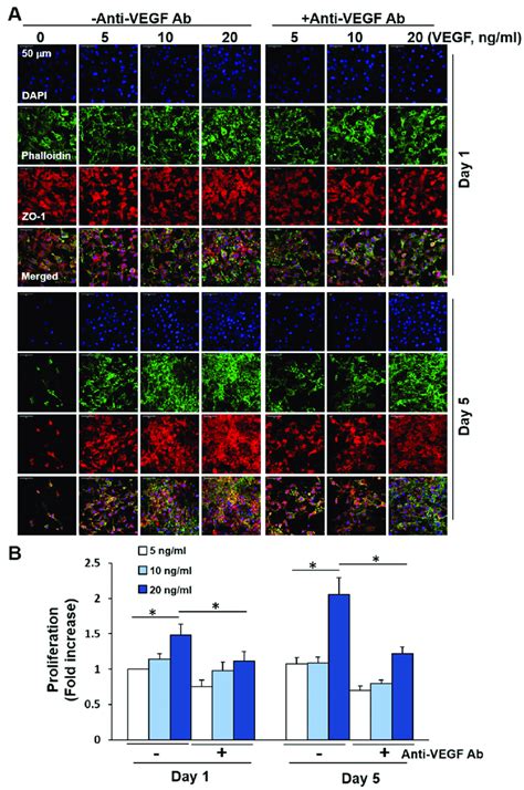 PCL and Preoperative Anti-VEGF Use for Membrane Dissection in …