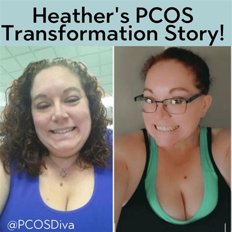 PCOS Success Story Heather PCOS Diva