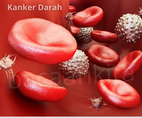 Pengobatan Kanker Darah - Halodoc - wintechmobiles.com