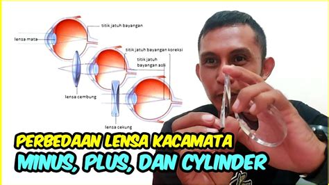 Perbedaan Lensa Minus Dan Silinder - wintechmobiles.com