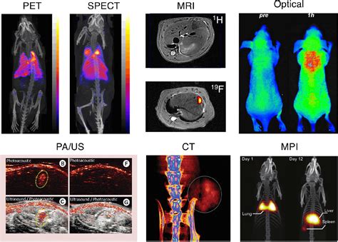 PET and SPECT Imaging of Neurotoxicity SpringerLink