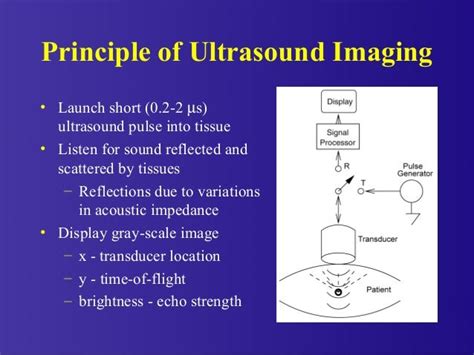 Physics and Principles of Ultrasound Imaging - Springer - wintechmobiles.com