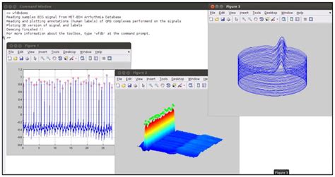 PhysioNet Databases - coolestguyplanet.net