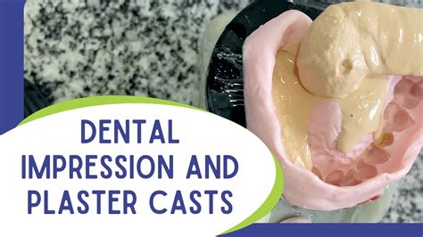 Plaster Casting and Impression Taking - Algeos - muktibox.com