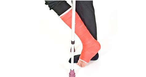 Plaster Casts For Sports Injury Treatment & Rehabilitation - muktibox.com