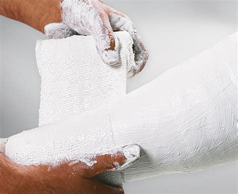 Plaster Of Paris Bandages - Casting and Moulding - muktibox.com