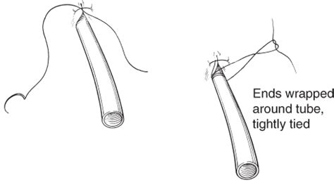 POTD: Chest Tube/Pig Tail Drain Suturing — …