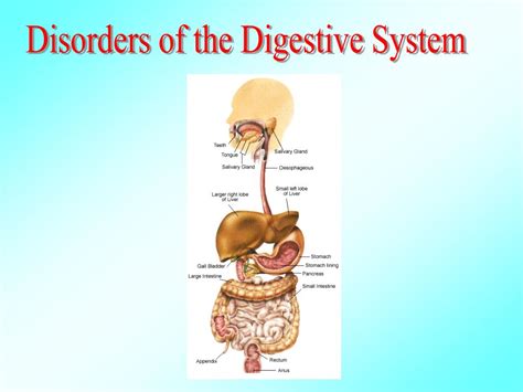 PPT Disorders of Digestive System PowerPoint Presentation, free