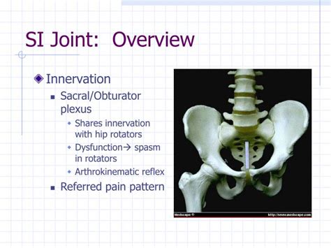 PPT Sacroiliac Dysfunction PowerPoint Presentation ID270693