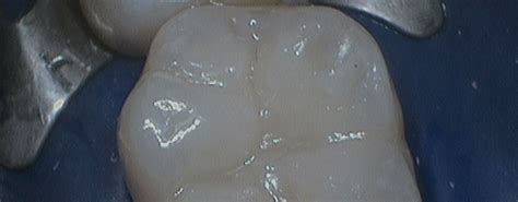 Professional Photo Restoration and Lifelike … - muktibox.com