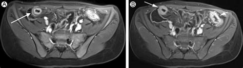 Progressive enhancement and restoration for mural … - muktibox.com