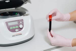Proper Use of Centrifuge for Blood Samples: Essential Protocols and ... - wintechmobiles.com