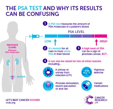 PSA Screening for Prostate Cancer ScienceBased Medicine