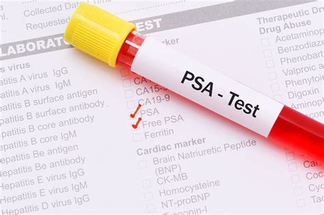 PSA Test