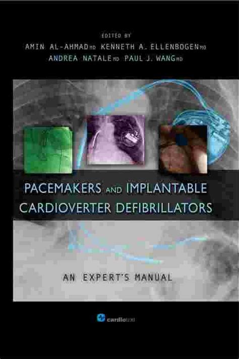 Pacemakers and implantable cardioverter defibrillators an expert s manual. - Turen går til københavn og nord-sjælland..
