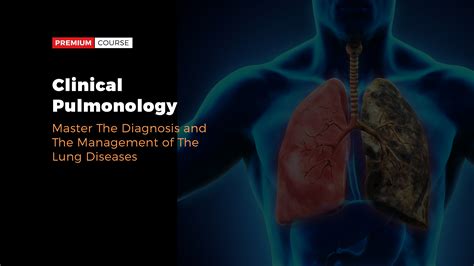 Paimonology - We have over 70 full-time faculty and part-time clinical faculty with expertise in diseases including asthma, COPD, critical care, cystic fibrosis, interstitial lung disease, lung cancer, lung transplantation, neuromuscular disease, pulmonary hypertension, sarcoidosis and sleep medicine. We strive to improve the health of our own patients and ... 