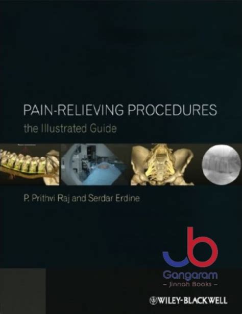 Pain relieving procedures the illustrated guide. - Amazon echo amazon echo user guide technologymobile communication kindle alexa computer hardware.
