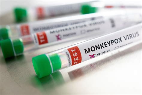 Pakistani health officials confirm first case of monkeypox