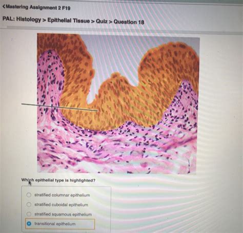 Ch 04 Tutorial Due: 11:59pm on Wednesday, June 22, 2016 You will receive no credit for items you complete after the assignment is due. Grading Policy Art­labeling Activity: Figure 4.11 Part A Drag the appropriate labels to their respective targets. ANSWER: Correct PAL: Histology > Epithelial Tissue > Quiz > Question 2 Part A.
