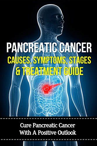 Pancreatic cancer causes symptoms stages treatment guide cure pancreatic cancer with a positive outlook. - 94 arctic cat 580 ext manual.