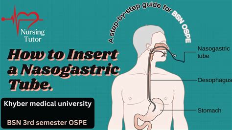 Pantoprazole in nasogastric tube? : r/nursing - reddit