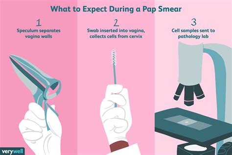 Pap Smear for Cervical Cancer Screening What to Expect & FAQs