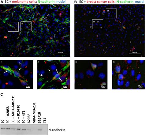 Paracellular and transcellular migration of metastatic cells …