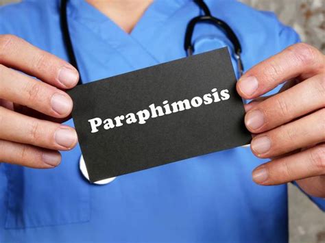 Paraphimose » wann wird eine Vorhautverengung zum Notfall?