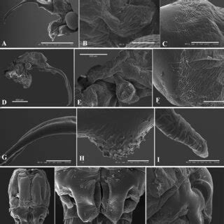 Scale bars: 2 mm (C, D). from publication: Parartemiopsis shangrilaensis, a new species of fairy shrimp (Branchiopoda, Anostraca) from Yunnan, with a key to the …. 