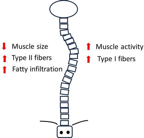 Paraspinal muscle stimulation for the treatment of idiopathic