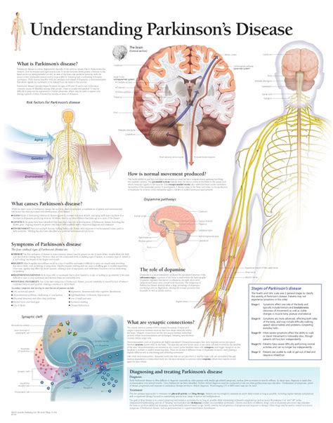 Parkinson disease Neurology