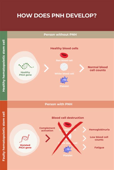 Paroxysmal Nocturnal Hemoglobinuria (PNH) - Johns Hopkins …