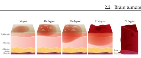 Partial Thickness & Full Thickness Graft Explained