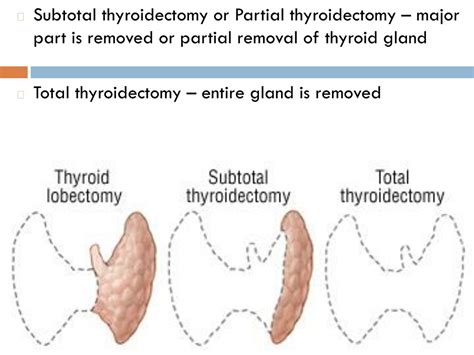 Partial Thyroidectomy (Discharge Care) - Drugs.com