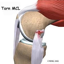 Patellar Tendon Tears Howard J. Luks, MD