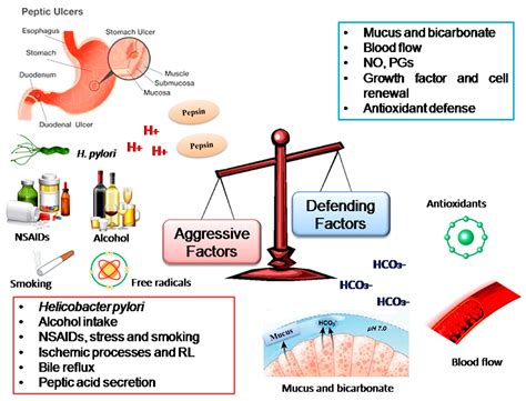 Pathophysiology For Peptic Ulcer Schematic Diagram