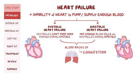 Pathophysiology of heart failure - Wikipedia