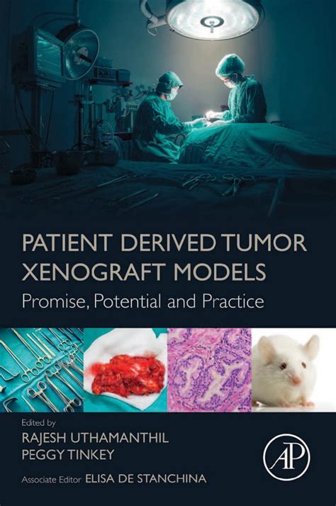 Full Download Patient Derived Tumor Xenograft Models Promise Potential And Practice By Rajesh Uthamanthil