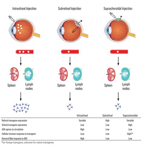 Patients guide to retinal gene therapy. - Here and there advent reflections from two cultures.