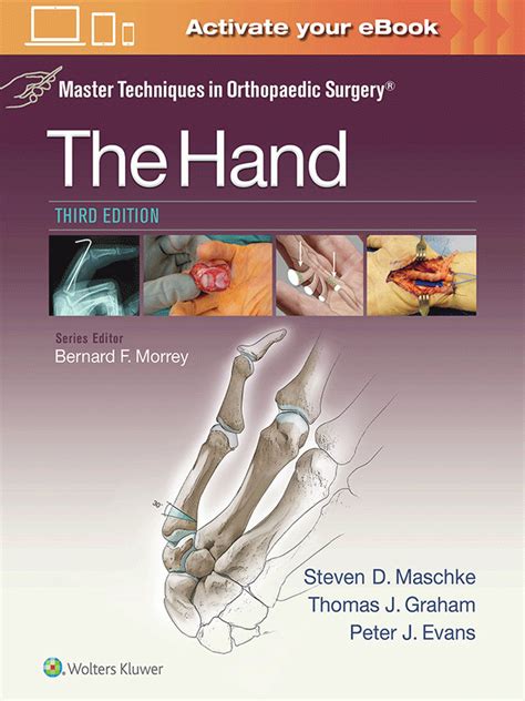 Pdf book master techniques orthopaedic surgery hand. - The theory of elastic waves and waveguides.