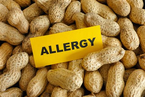 Peanut allergy DermNet